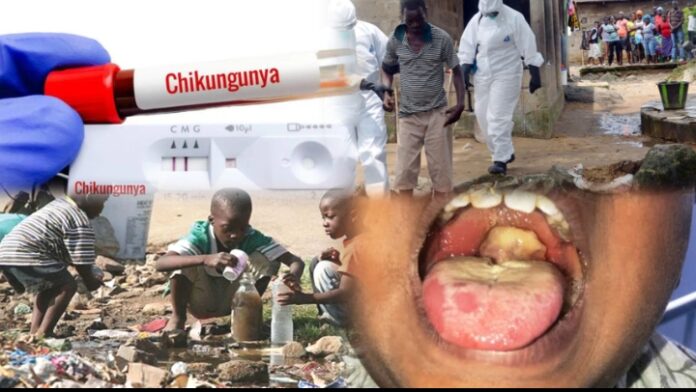 Photo showing chikungunya, ebola, diphtheria and cholera diseases outbreaks